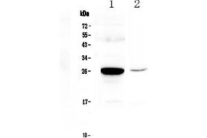 Western blot analysis of MBL2 using anti-MBL2 antibody . (MBL2 antibody  (AA 39-229))