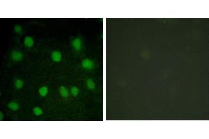 serum + -Immunofluorescence analysis of HuvEc cells, treated with serum (20%, 30mins), using Dematin (Ab-403) antibody. (Dematin antibody  (Ser403))