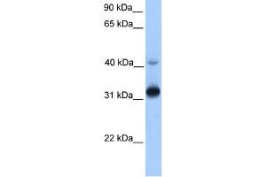 WB Suggested Anti-GPSN2 Antibody Titration:  0. (TECR antibody  (Middle Region))
