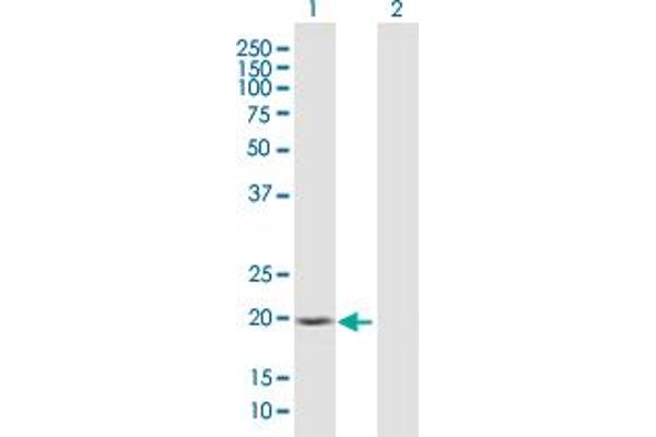 SSH2 anticorps  (AA 1-178)