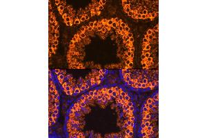 Immunofluorescence analysis of Mouse testis cells using PIWIL1 antibody (ABIN3023049, ABIN3023050, ABIN3023051 and ABIN6219364) at dilution of 1:100. (PIWIL1 antibody)