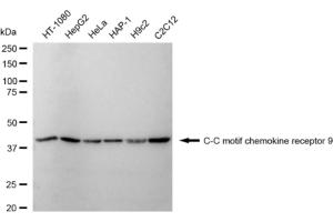 anti-Chemokine Binding Protein 2 (CCBP2) antibody