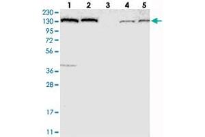 Western blot analysis of Lane 1: RT-4, Lane 2: U-251 MG, Lane 3: Human Plasma, Lane 4: Liver, Lane 5: Tonsil with PFAS polyclonal antibody  at 1:250-1:500 dilution. (PFAS antibody)