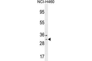 WBSCR27 Antibody (N-term) western blot analysis in NCI-H460 cell line lysates (35 µg/lane). (WBSCR27 antibody  (N-Term))