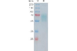 SDS-PAGE (SDS) image for Tumor Necrosis Factor Receptor Superfamily, Member 8 (TNFRSF8) (AA 19-379) protein (His tag) (ABIN6961166)