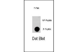 Dot blot analysis of anti-AKT3-p Phospho-specific Pab (R) on nitrocellulose membrane. (AKT3 antibody  (pSer472))