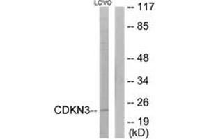Western blot analysis of extracts from LOVO cells, using CDKN3 Antibody. (CDKN3 antibody  (AA 31-80))