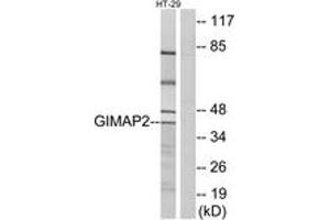 Western Blotting (WB) image for anti-GTPase, IMAP Family Member 2 (GIMAP2) (AA 201-250) antibody (ABIN2890360) (GIMAP2 antibody  (AA 201-250))