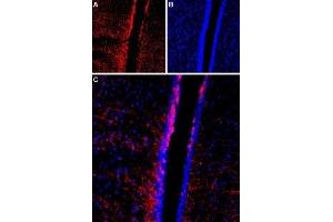 Expression of TRPC4 in rat brain - Immunohistochemical staining of rat third ventricle region using Anti-TRPC4 (extracellular) Antibody (ABIN7043822, ABIN7044067 and ABIN7044068). (TRPC4 antibody  (2nd Extracellular Loop))