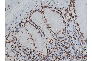 Immunohistochemistry (IHC) image for anti-Histone 3 (H3) (H3K9ac) antibody (ABIN6254904)