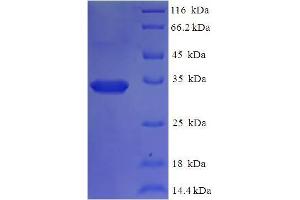 SDS-PAGE (SDS) image for Kinesin Family Member 1C (KIF1C) (AA 1-272) protein (His tag) (ABIN4975017) (KIF1C Protein (AA 1-272) (His tag))