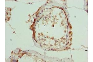 Immunohistochemistry of paraffin-embedded human testis tissue using ABIN7166405 at dilution of 1:100 (ARMT1 (AA 2-250) antibody)