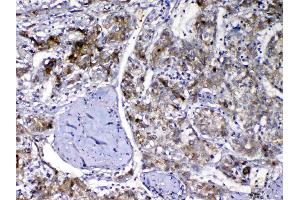 IHC analysis of Vitamin D Binding protein using anti-Vitamin D Binding protein antibody . (Gc (AA 17-256) antibody)
