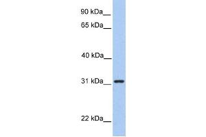Western Blotting (WB) image for anti-Signal Recognition Particle Receptor, B Subunit (SRPRB) antibody (ABIN2459317)