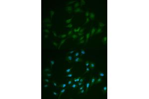 Immunofluorescence analysis of MCF-7 cells using LIG1 antibody. (LIG1 antibody)