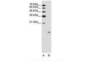 Image no. 1 for anti-Glucagon (GCG) (AA 41-90) antibody (ABIN203495) (Glucagon antibody  (AA 41-90))