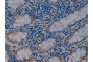 DAB staining on IHC-P; Samples: Human Rectum Tissue (PDK1 antibody  (AA 233-430))