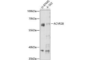 Western blot analysis of extracts of various cell lines, using B antibody (ABIN7265414) at 1:3000 dilution. (ACVR2B antibody  (AA 50-150))