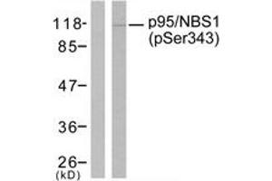 Western blot analysis of extracts from Jurkat cells, using p95/NBS1 (Phospho-Ser343) Antibody. (Nibrin antibody  (pSer343))
