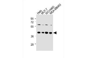 All lanes : Anti-LTM4B-4 Antibody at 1:250 dilution Lane 1: Hela whole cell lysates Lane 2: MCF-7 whole cell lysates Lane 3: NCI- whole cell lysates Lane 4: MDA-M whole cell lysates Lysates/proteins at 20 μg per lane. (LAPTM4B antibody  (AA 195-209))