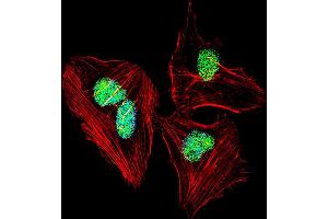 Fluorescent confocal image of Hela cell stained with NFIA Antibody .