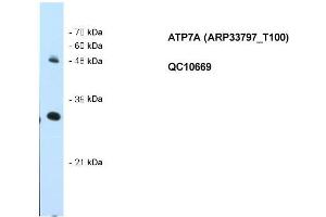 Western Blotting (WB) image for anti-ATPase, Cu++ Transporting, alpha Polypeptide (ATP7A) (N-Term) antibody (ABIN2778125)