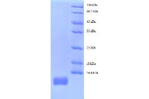 Chemokine (C-C Motif) Ligand 18 (Pulmonary and Activation-Regulated) (CCL18) (AA 21-89) protein (His tag) expressed in yeast