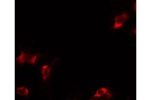 ABIN6269348 staining HepG2 by IF/ICC. (BIK antibody)