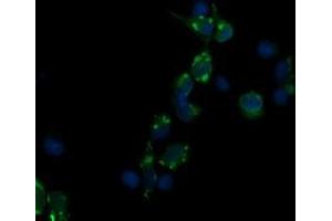 Image no. 4 for anti-CD3 epsilon (CD3E) antibody (ABIN1497222) (CD3 epsilon antibody)