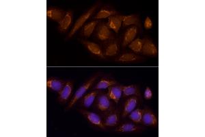 Immunofluorescence analysis of U2OS using SUCL antibody (ABIN6132955, ABIN6148688, ABIN6148689 and ABIN6214151) at dilution of 1:100 (40x lens). (SUCLA2 antibody  (AA 1-180))