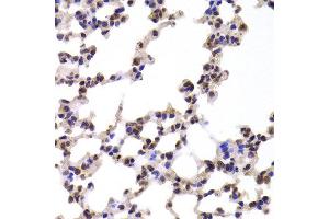 Immunohistochemistry of paraffin-embedded Mouse lung using CMPK1 antibody at dilution of 1:100 (x400 lens). (Cytidine Monophosphate (UMP-CMP) Kinase 1, Cytosolic (CMPK1) antibody)