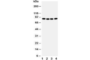 Western blot testing of CUL2 antibody and human samples 1:  A431;  2: SMMC-7721;  3: HeLa;  4: COLO320 cell lysate. (Cullin 2 antibody  (Middle Region))