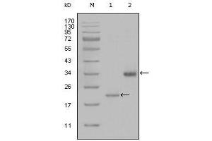 Western Blot showing LPA antibody used against truncated LPA-His recombinant protein (1) and truncated Trx-LPA (aa4330-4521) recombinant protein (2). (LPA antibody)