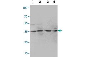 Western blot analysis of tissue lysates with MTA1 polyclonal antibody . (MTA1 antibody  (C-Term))