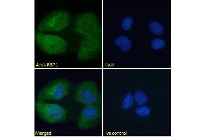 Immunofluorescence (IF) image for anti-Retinol Binding Protein 1, Cellular (RBP1) (C-Term) antibody (ABIN185365)