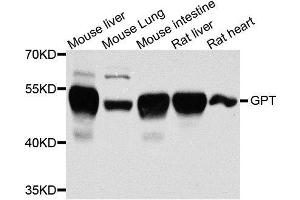 Western blot analysis of extracts of various cell lines, using GPT antibody. (ALT antibody  (AA 1-190))