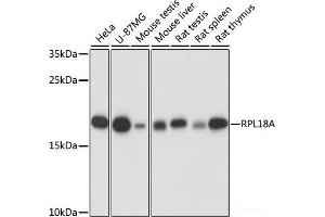 Western blot analysis of extracts of various cell lines using RPL18A Polyclonal Antibody at dilution of 1:1000. (RPL18A antibody)