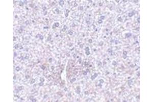 Immunohistochemistry of TEM7 in mouse liver tissue with this product at 2. (PLXDC1 antibody  (Center))