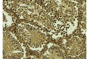 ABIN6277431 at 1/100 staining Mouse testis tissue by IHC-P. (RAD50 antibody  (Internal Region))