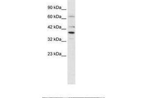 Image no. 2 for anti-POU Domain, Class 4, Transcription Factor 3 (POU4F3) (AA 211-260) antibody (ABIN202275) (POU4F3 antibody  (AA 211-260))