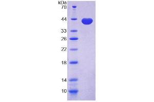 SDS-PAGE (SDS) image for Cadherin 5 (CDH5) (AA 67-390) protein (His tag) (ABIN4988687)