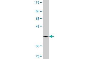 Western Blot detection against Immunogen (37.