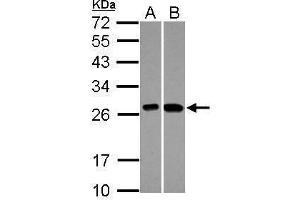 WB Image Sample (30 ug of whole cell lysate) A: A549 B: HepG2 12% SDS PAGE antibody diluted at 1:1000 (KNP-1 (Center) antibody)