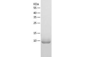 Western Blotting (WB) image for Bromodomain PHD Finger Transcription Factor (BPTF) (AA 2796-2907) protein (His tag) (ABIN7287035) (BPTF Protein (AA 2796-2907) (His tag))