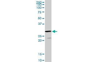 GSTZ1 monoclonal antibody (M01), clone 1G12. (GSTZ1 antibody  (AA 109-216))
