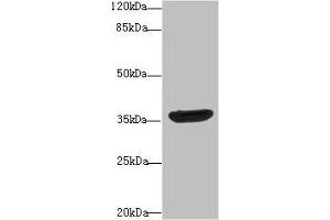 Western blot All lanes: DNAJB2 antibody at 10 μg/mL + A431 whole cell lysate Secondary Goat polyclonal to rabbit IgG at 1/10000 dilution Predicted band size: 36, 31 kDa Observed band size: 36 kDa (DNAJB2 antibody  (AA 2-324))