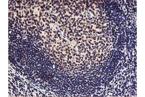 Immunohistochemistry (IHC) image for anti-Homeobox C11 (HOXC11) (AA 1-304) antibody (ABIN1490735)