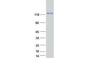 Validation with Western Blot (RIN3 Protein (Myc-DYKDDDDK Tag))