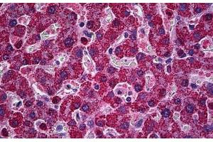 Human Liver: Formalin-Fixed, Paraffin-Embedded (FFPE) (PIM1 antibody  (AA 1-314))