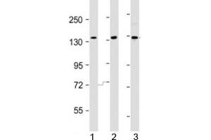 Western blot testing of AATK antibody at 1:2000 dilution. (AATK antibody  (AA 46-74))